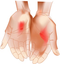 The Wounds of the Hands of Jesus